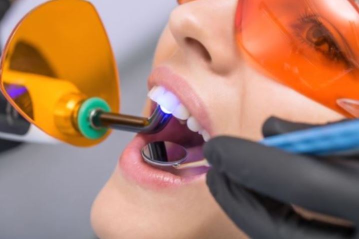 LASER DENTISTRY